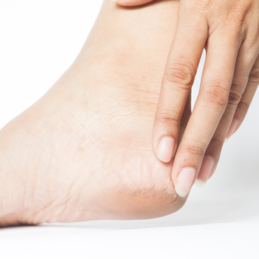 Co stosować na bardzo suche stopy?